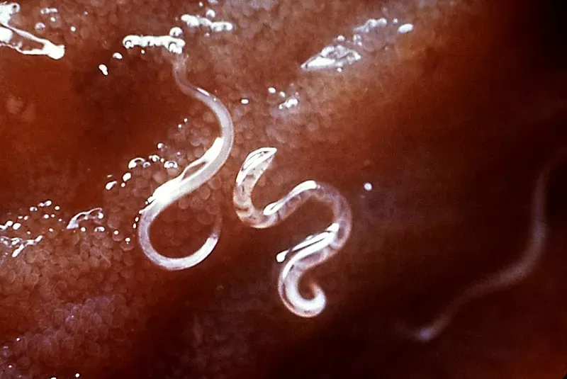 Hookworm - Wikipedia