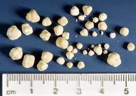 Bladder Stones in Cats