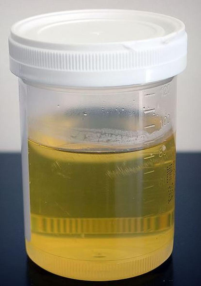 Normal Color of Dog Urine