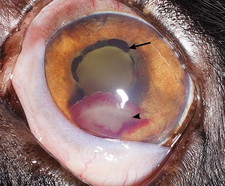 Diseases of the Iris