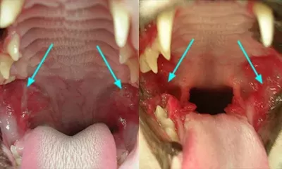 Mouth (Stomatitis)