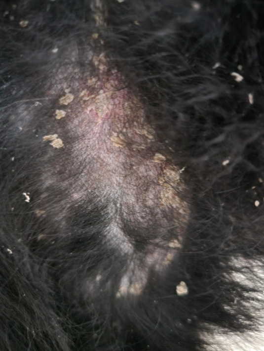 Dog Psoriasis Causes, Symptoms, and Treatment