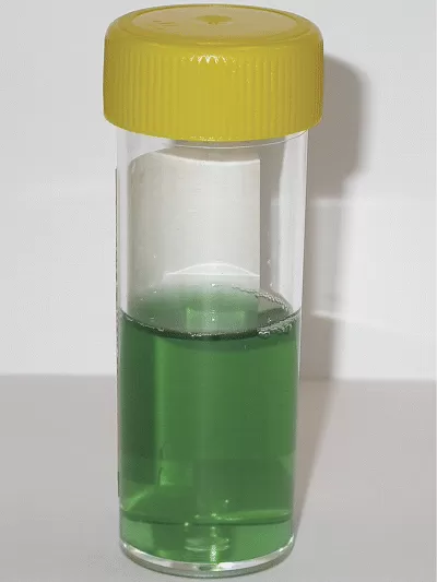 Medications and green urine 