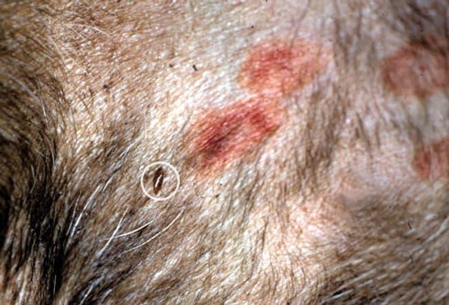 Hot Spots von Flöhen