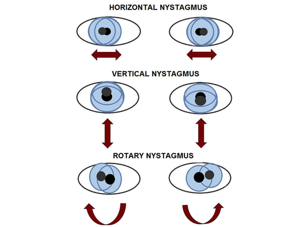 nystagmus in dogs