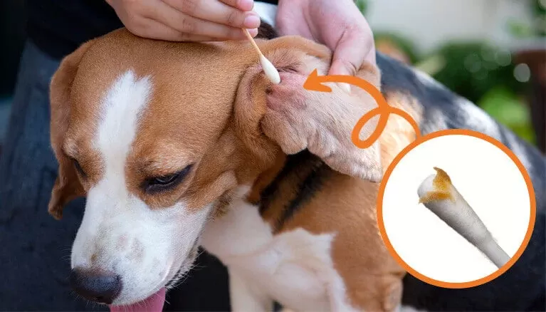 Ear Wax