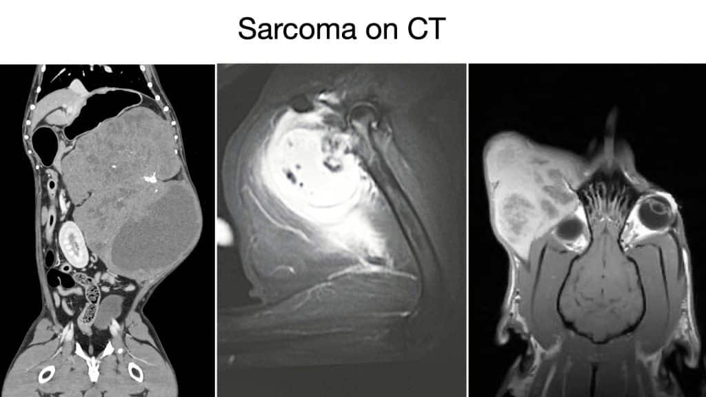 Sarcoma in Dogs