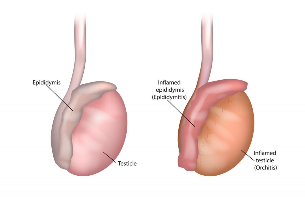 Orchitis in Dogs