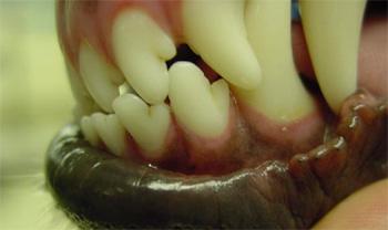 canine tooth misalignment