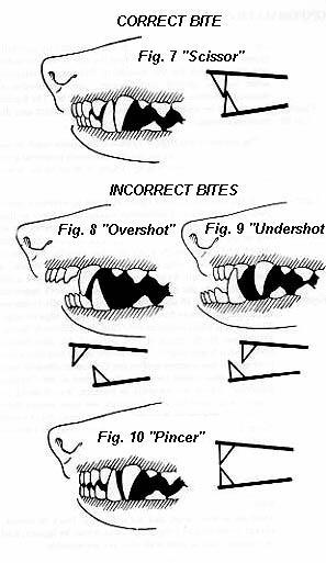 canine tooth misalignment