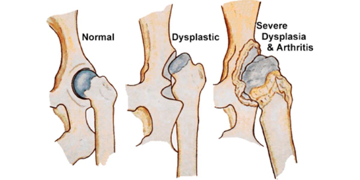 hip dysplasia in canines