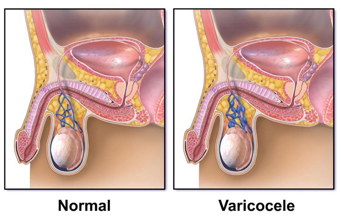 Os cães podem pegar uma varicocele no escroto